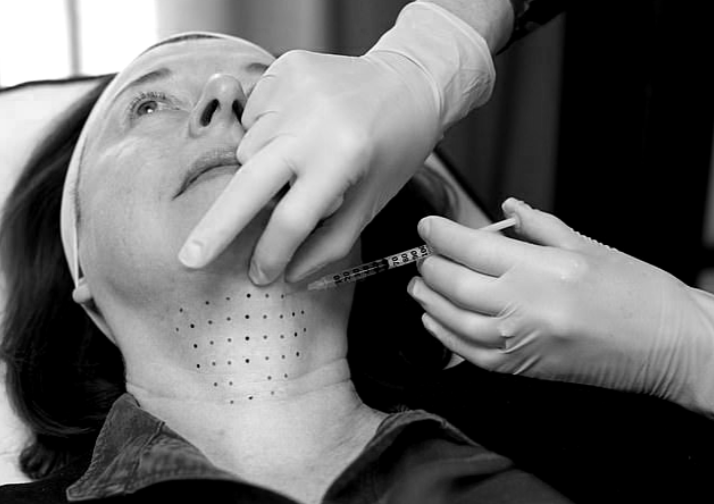CoolSculpting: The Prager Clinic’s Alternative