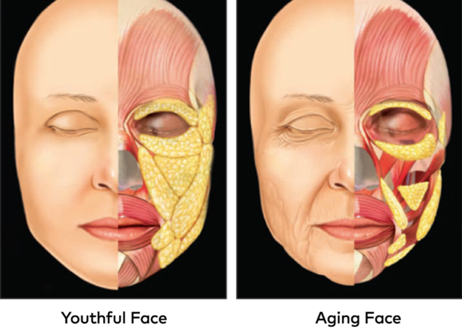 How and why we age, Part 2: Volume Loss
