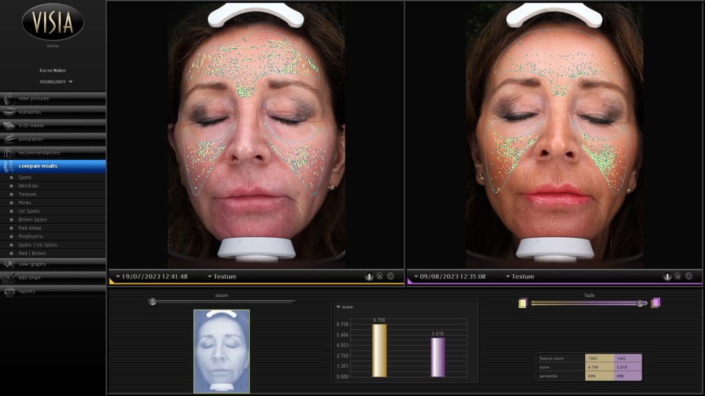 Smooth skin facials at Prager