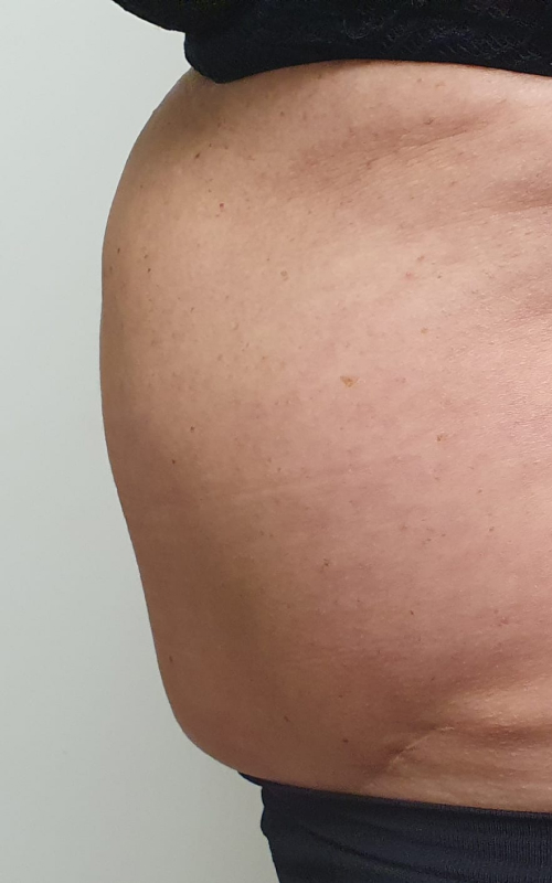 aqualyx-before