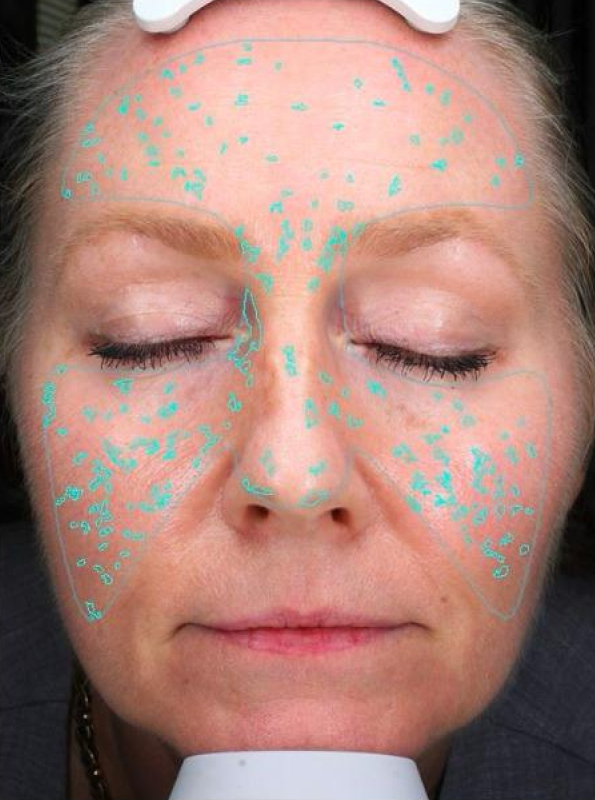 dr-prager-skincare-before
