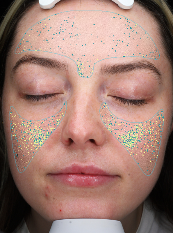 illuminator-facial-texture-before