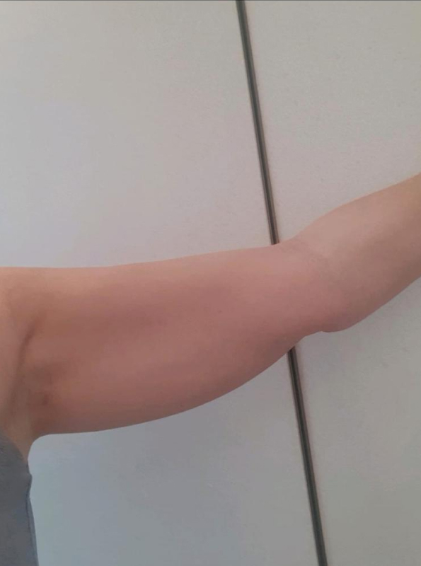 legacy-treatment-arms-before