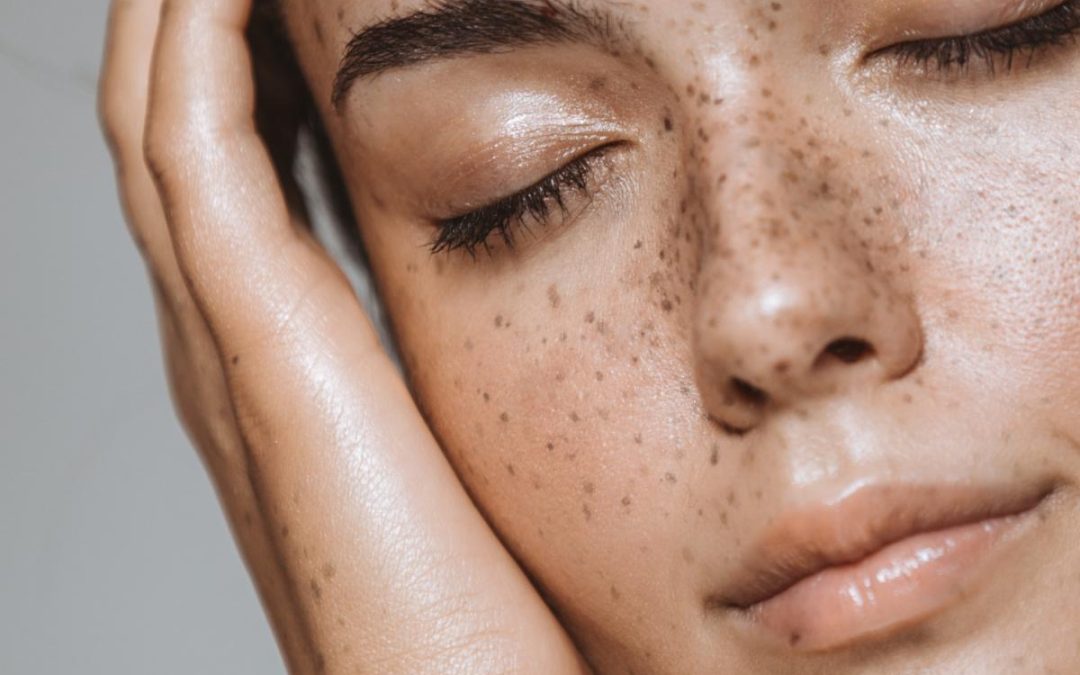 THE BURNING ISSUE OF SKIN RESURFACING